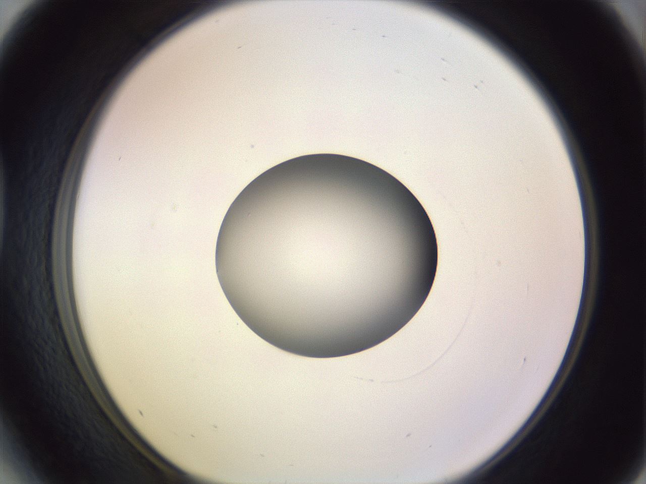 folderID417_plateID1417_batchID5188_wellNum41_profileID1_d1_r86650_ef.jpg