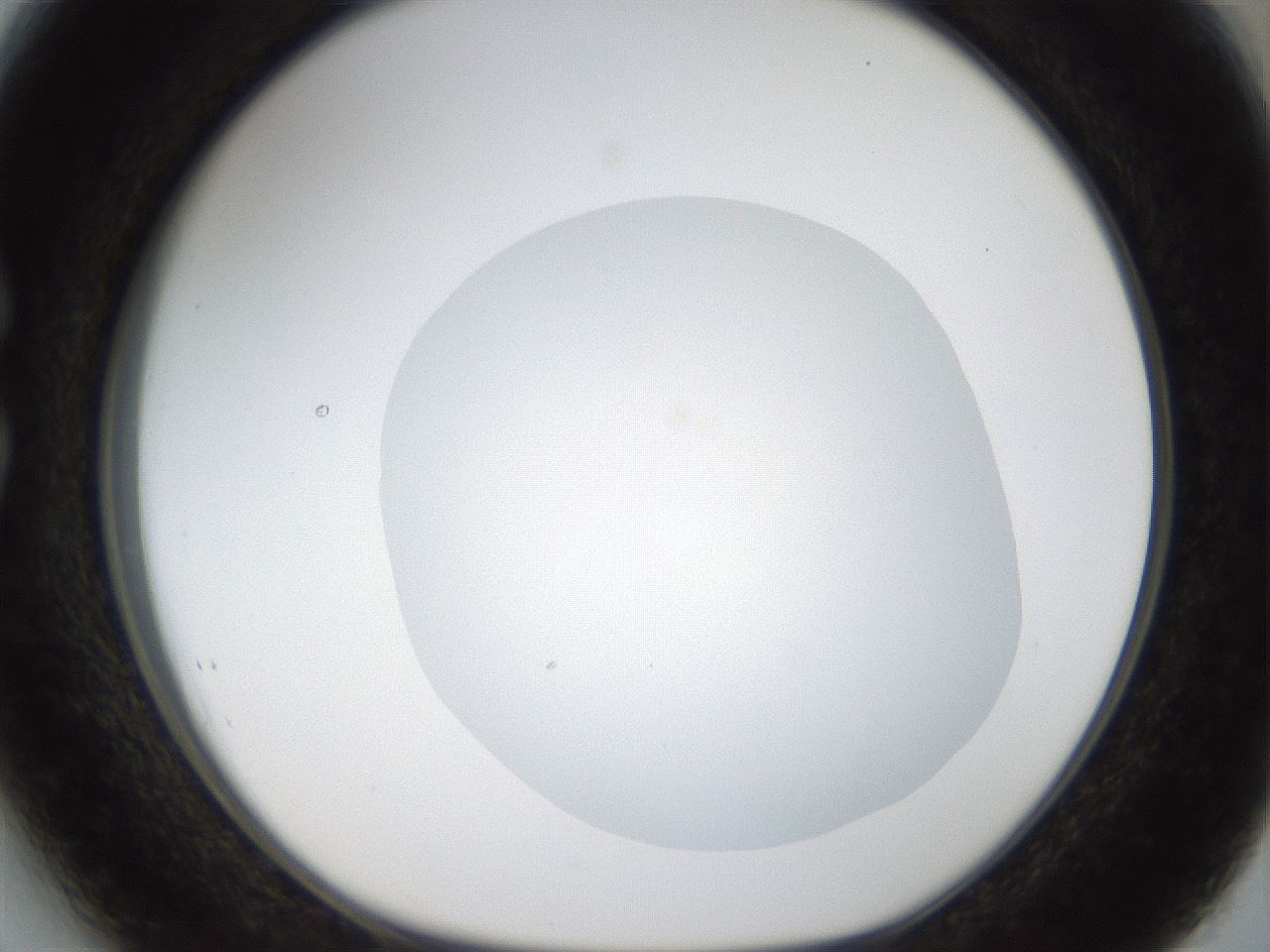 folderID18_plateID1018_batchID1888_wellNum27_profileID1_d1_r43102_ef.jpg
