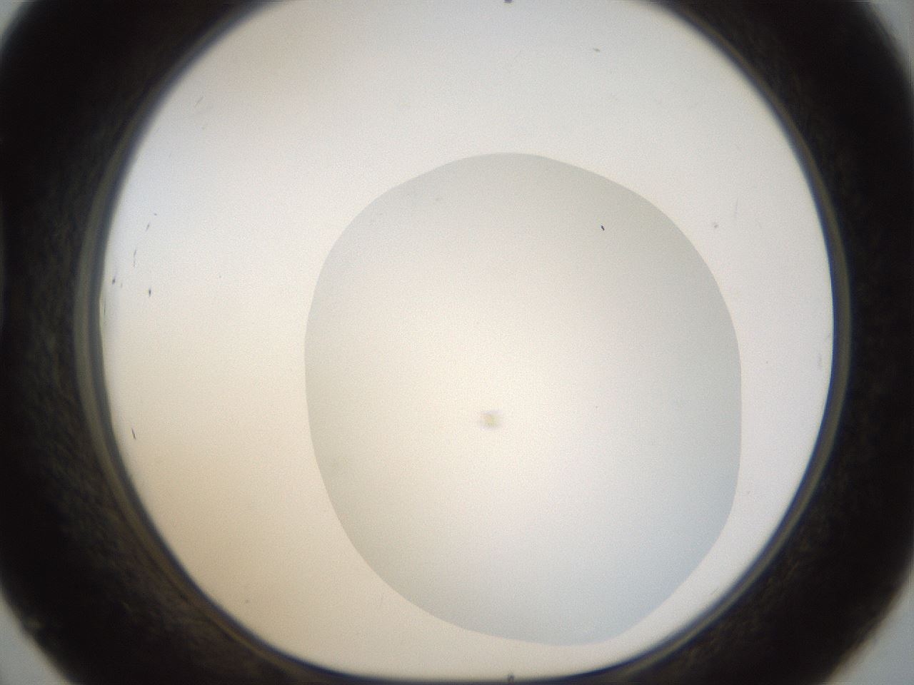 folderID18_plateID1018_batchID1888_wellNum45_profileID1_d1_r43120_ef.jpg