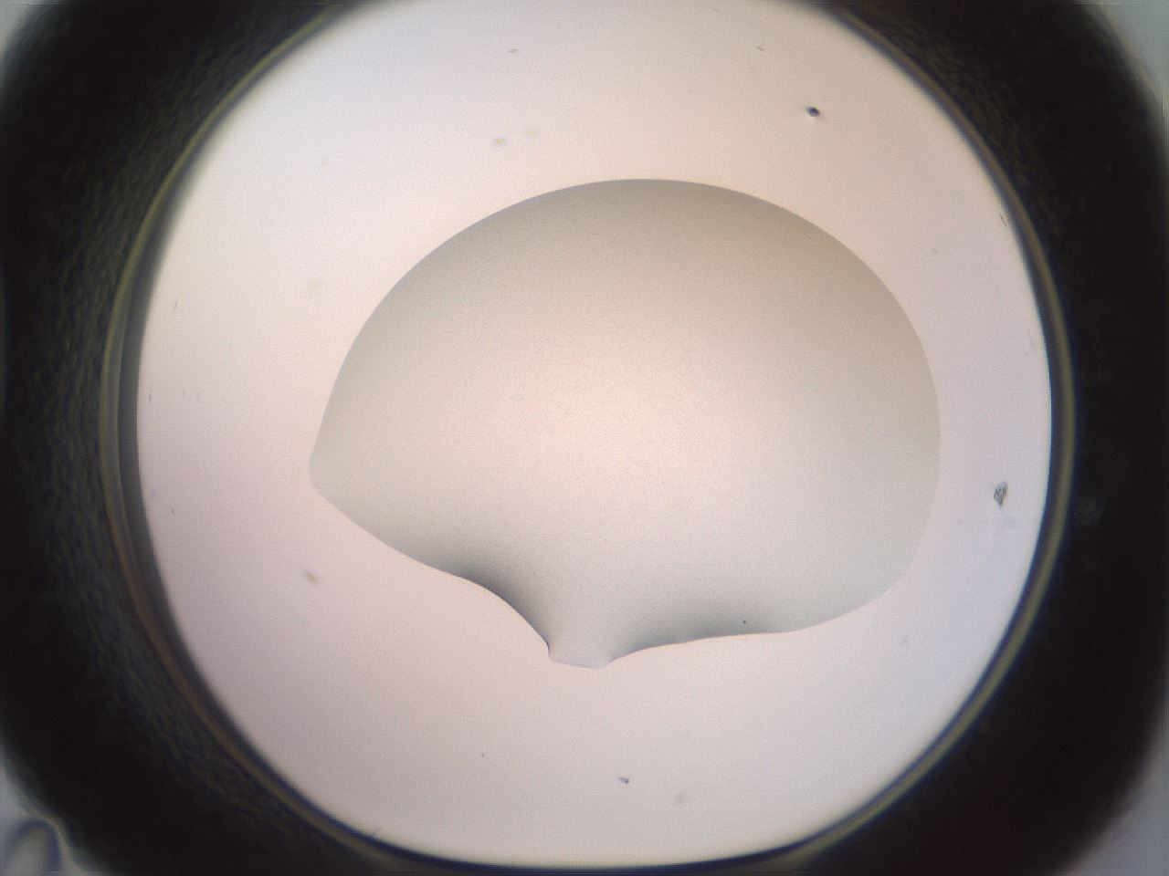 folderID417_plateID2417_batchID11657_wellNum47_profileID1_d1_r179118_ef.jpg