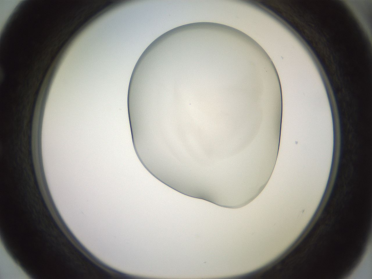 folderID417_plateID2417_batchID11657_wellNum52_profileID1_d1_r179123_ef.jpg