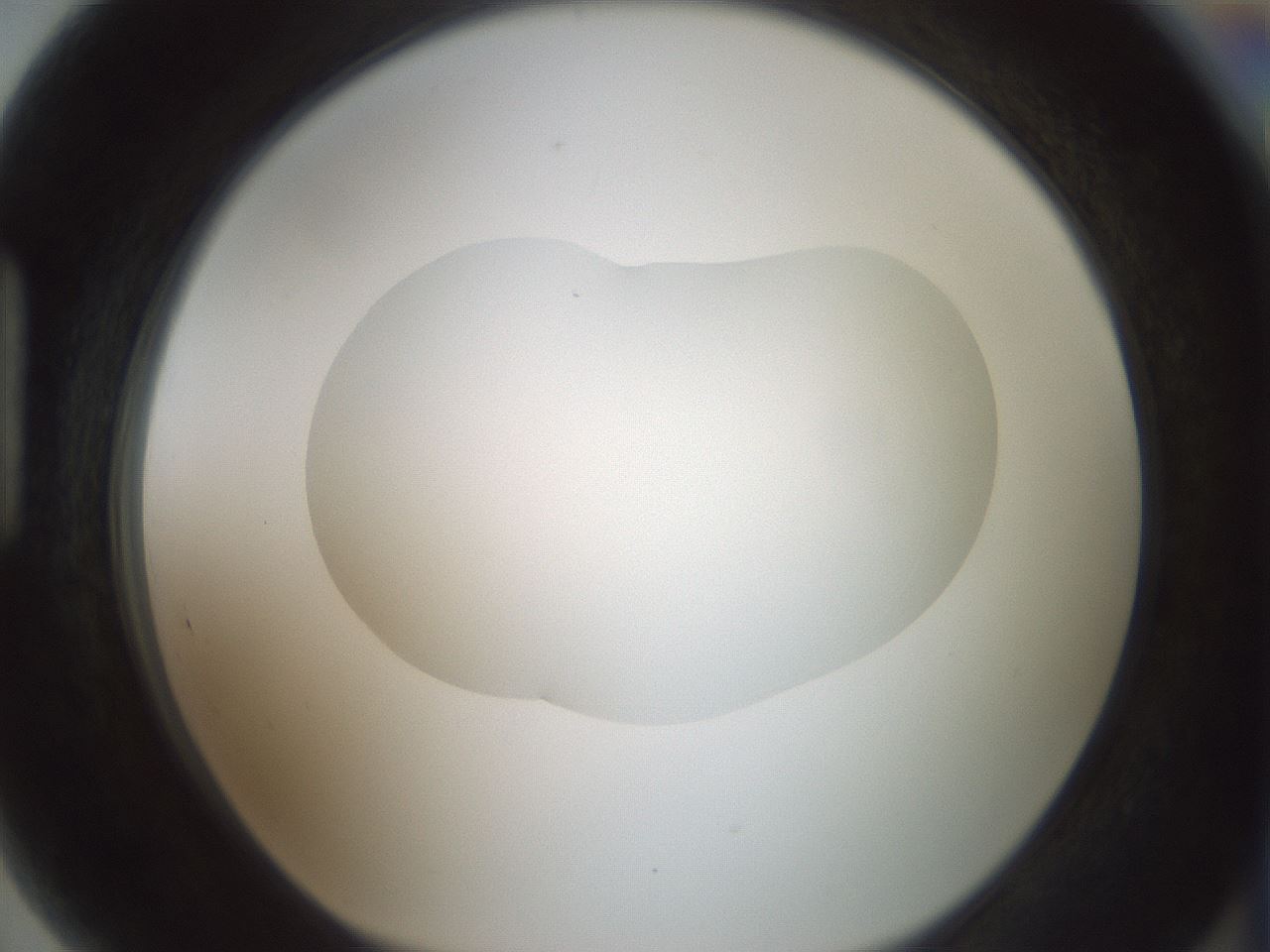 folderID418_plateID1418_batchID5195_wellNum89_profileID1_d1_r87274_ef.jpg
