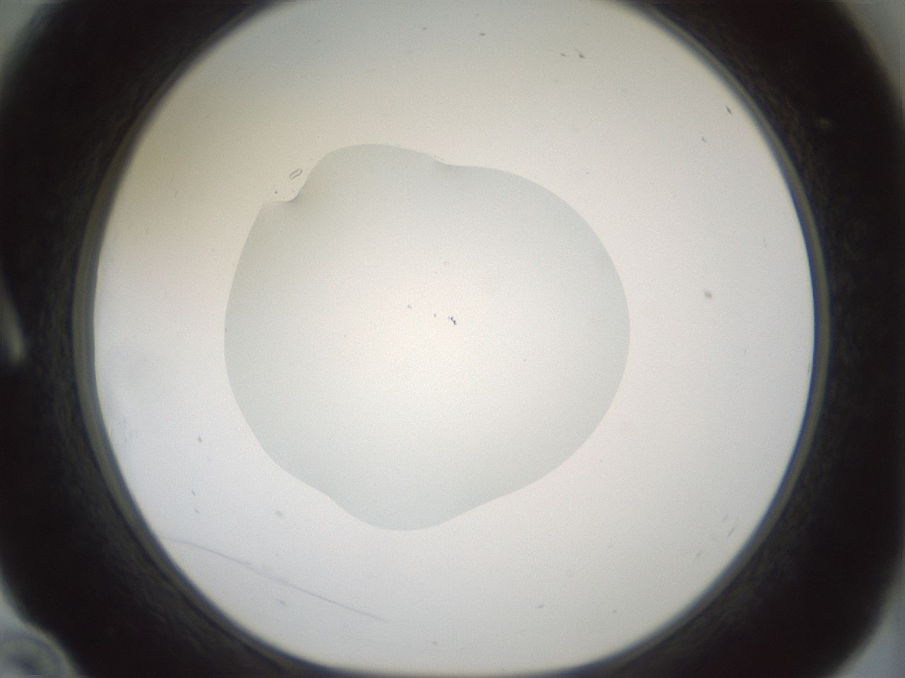 folderID418_plateID1418_batchID5195_wellNum10_profileID1_d1_r87195_ef.jpg