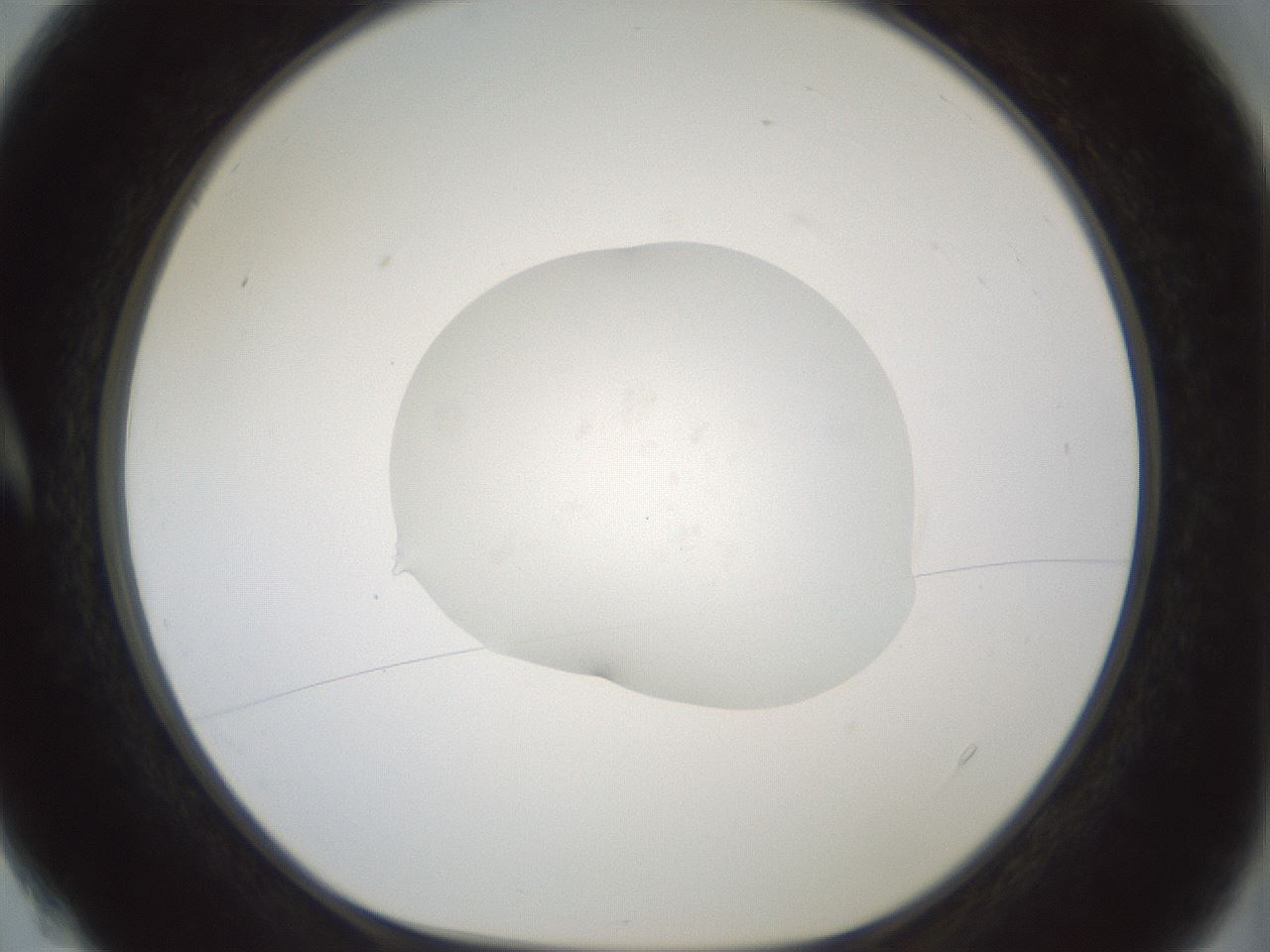 folderID418_plateID1418_batchID5195_wellNum4_profileID1_d1_r87189_ef.jpg