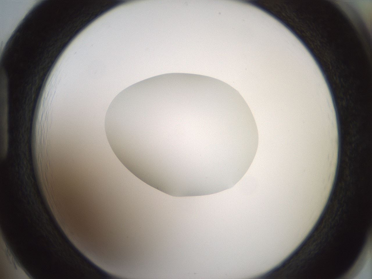folderID418_plateID1418_batchID5195_wellNum85_profileID1_d1_r87270_ef.jpg