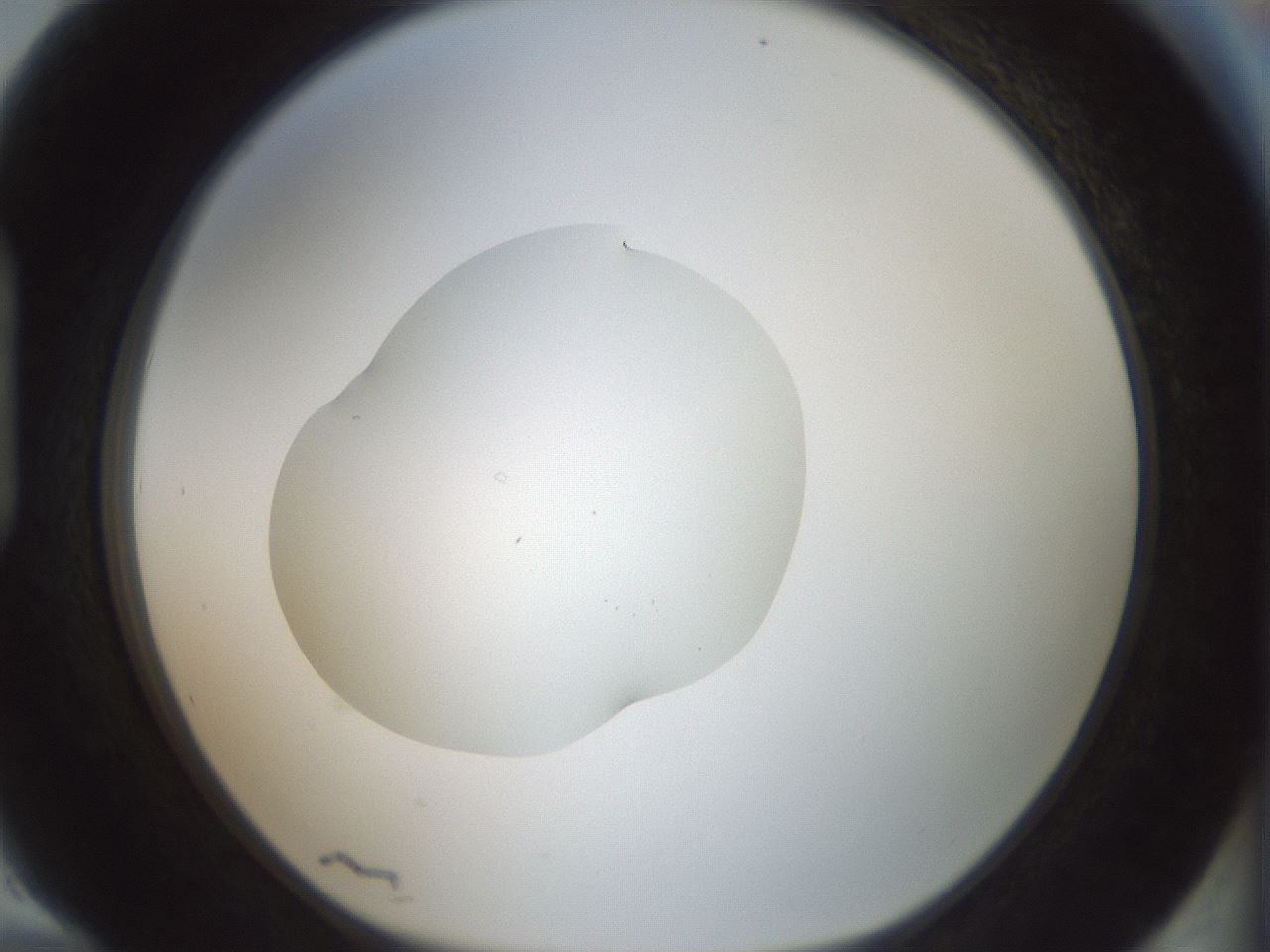 folderID418_plateID1418_batchID5195_wellNum94_profileID1_d1_r87279_ef.jpg