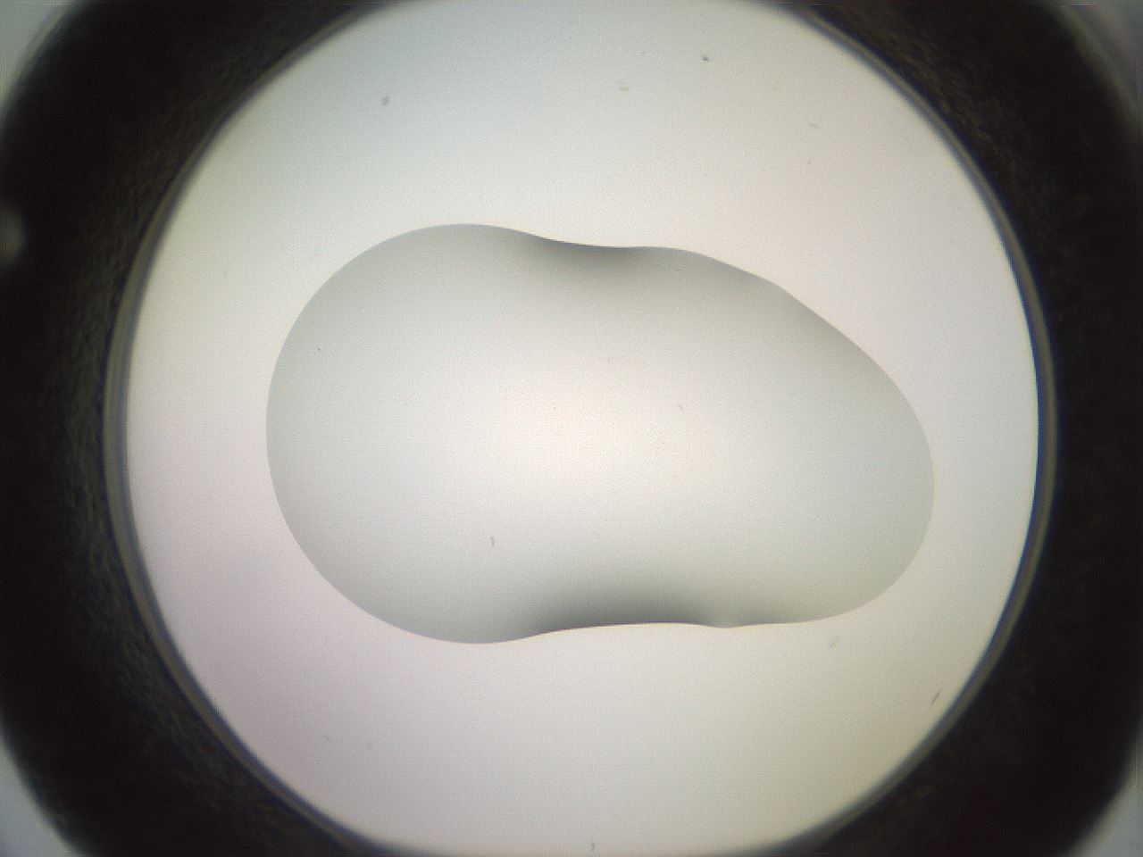 folderID418_plateID2418_batchID11659_wellNum62_profileID1_d1_r179325_ef.jpg