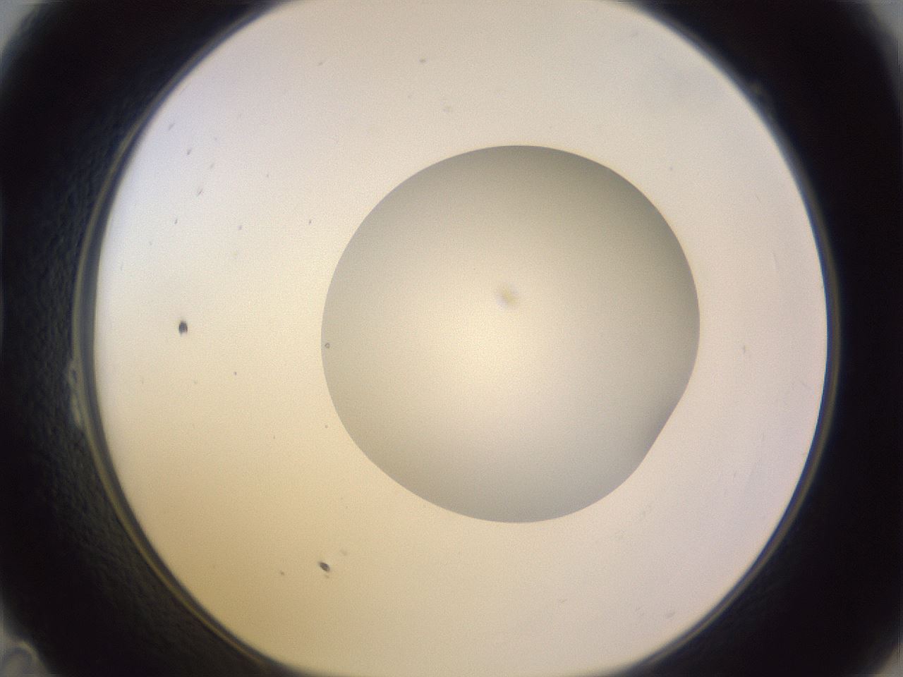 folderID419_plateID1419_batchID5194_wellNum23_profileID1_d1_r87016_ef.jpg