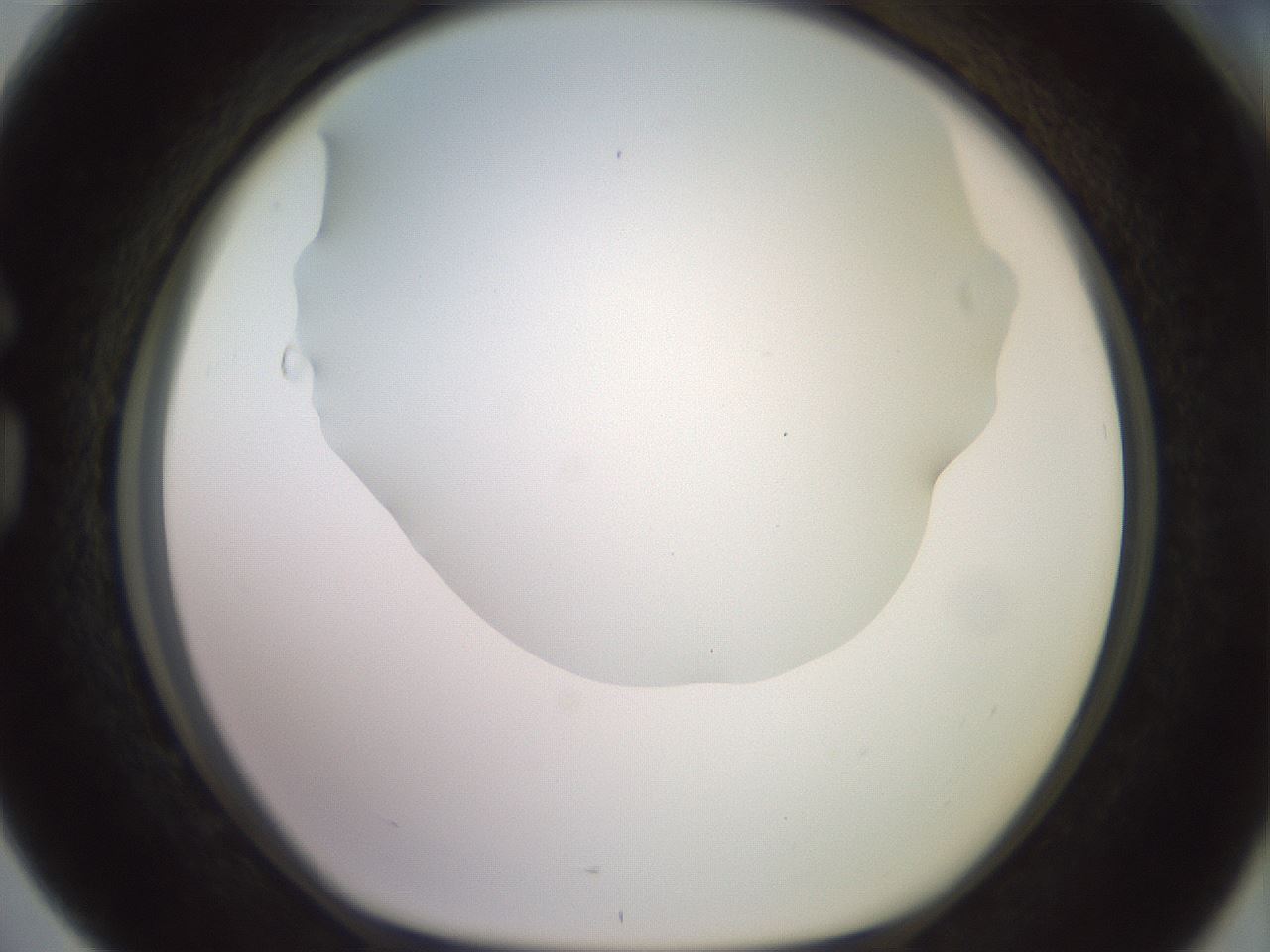 folderID419_plateID2419_batchID11660_wellNum76_profileID1_d1_r179435_ef.jpg