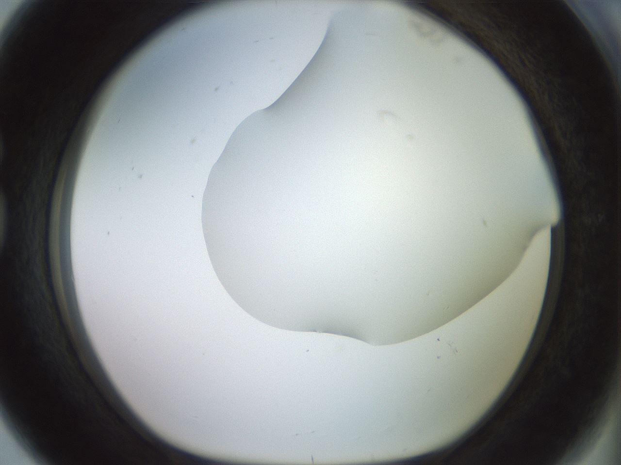 folderID419_plateID2419_batchID11660_wellNum80_profileID1_d1_r179439_ef.jpg