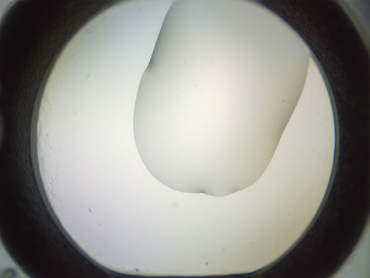 folderID419_plateID2419_batchID11660_wellNum83_profileID1_d1_r179442_ef.jpg