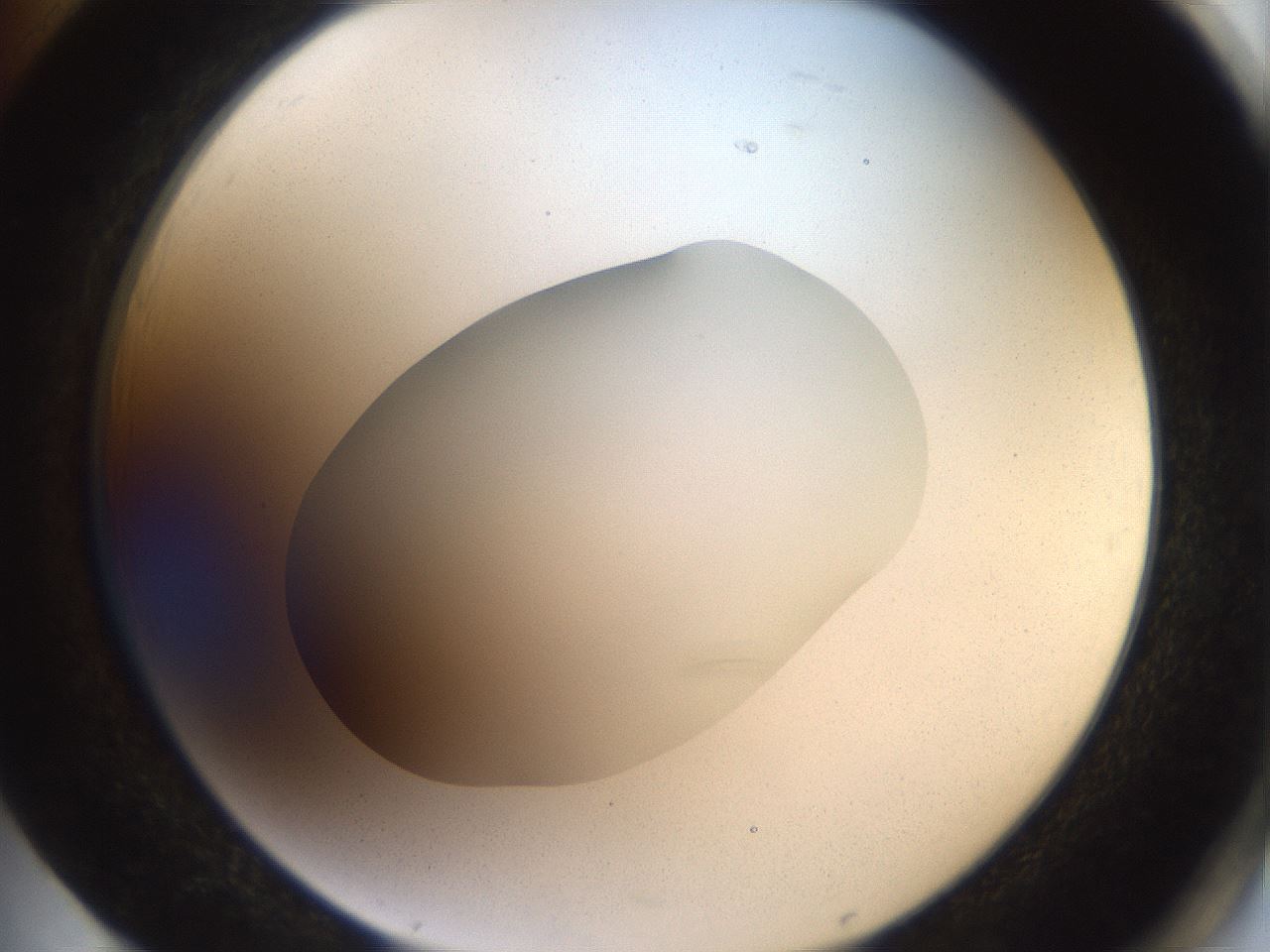folderID41_plateID2041_batchID9006_wellNum85_profileID1_d2_r137440_ef.jpg