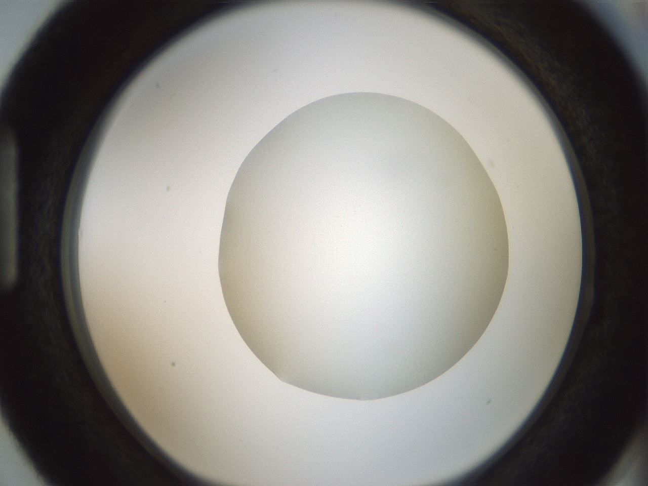folderID428_plateID1428_batchID5438_wellNum87_profileID1_d1_r90053_ef.jpg
