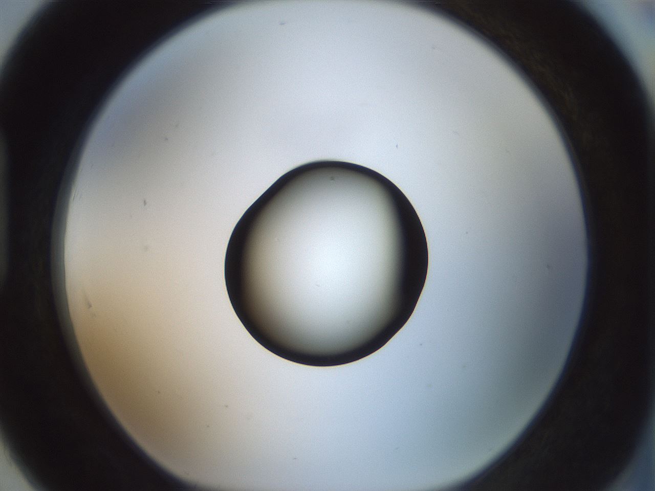 folderID429_plateID1429_batchID5435_wellNum91_profileID1_d1_r89293_ef.jpg