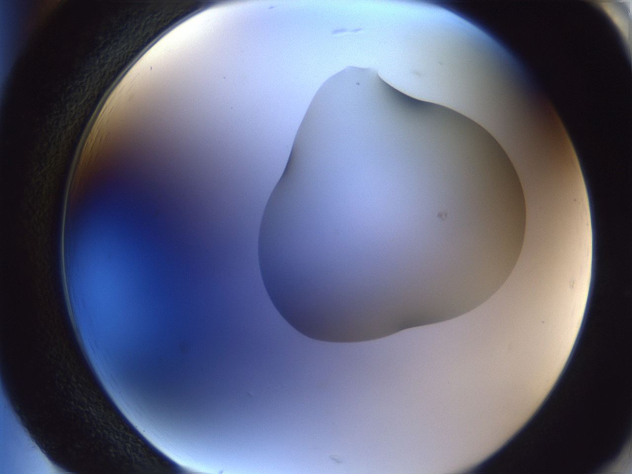 folderID44_plateID1044_batchID2102_wellNum85_profileID1_d2_r46705_ef.jpg