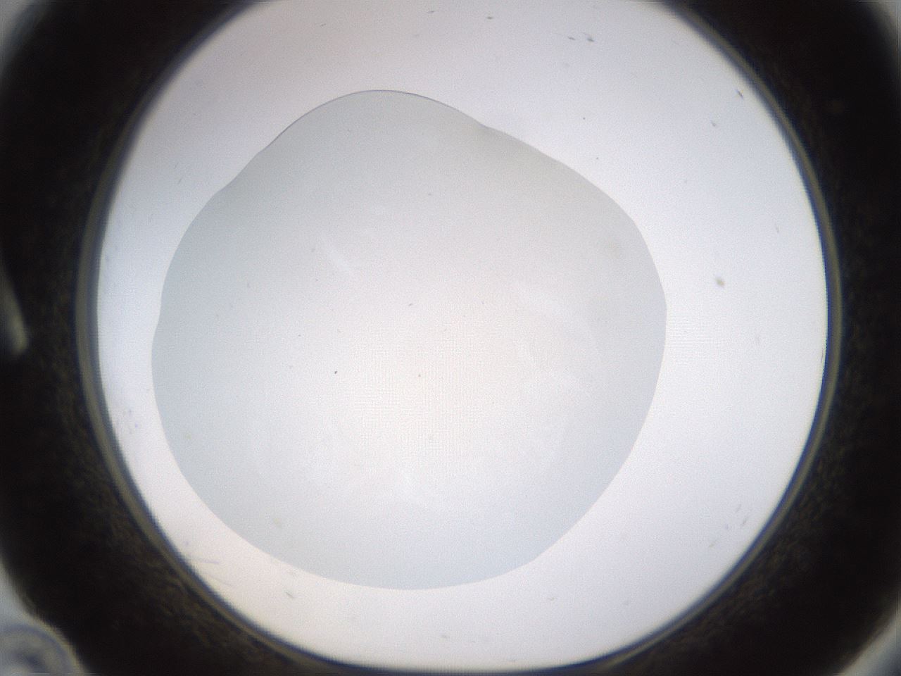 folderID520_plateID1520_batchID5989_wellNum10_profileID1_d1_r97379_ef.jpg