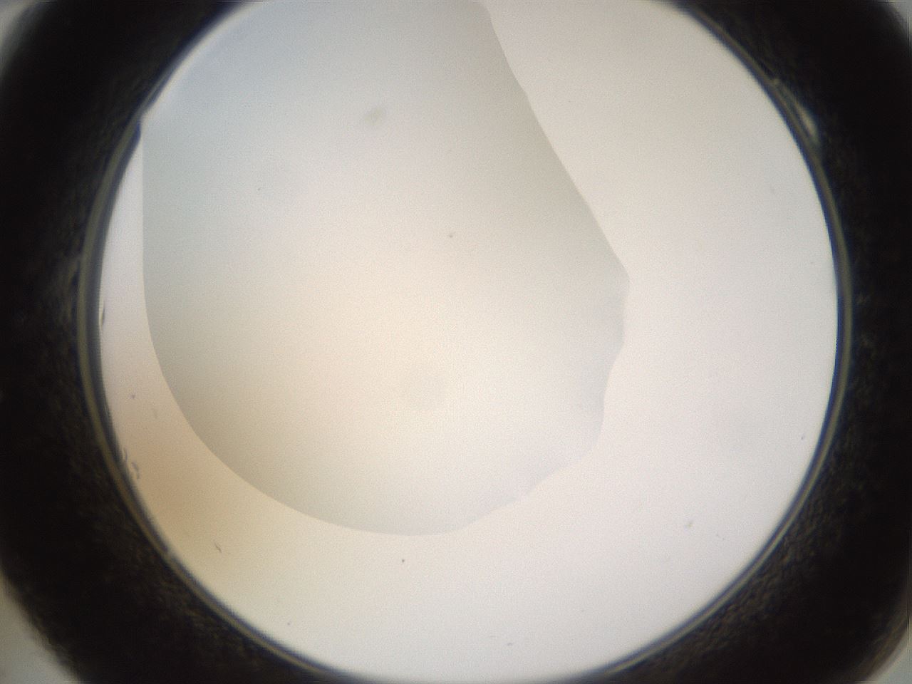 folderID520_plateID1520_batchID5989_wellNum10_profileID1_d2_r97380_ef.jpg