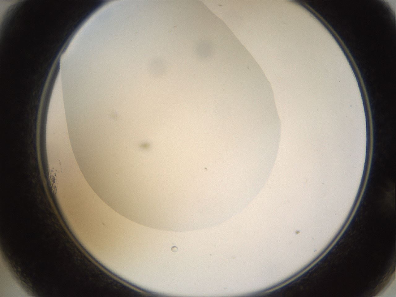 folderID520_plateID1520_batchID5989_wellNum11_profileID1_d2_r97382_ef.jpg