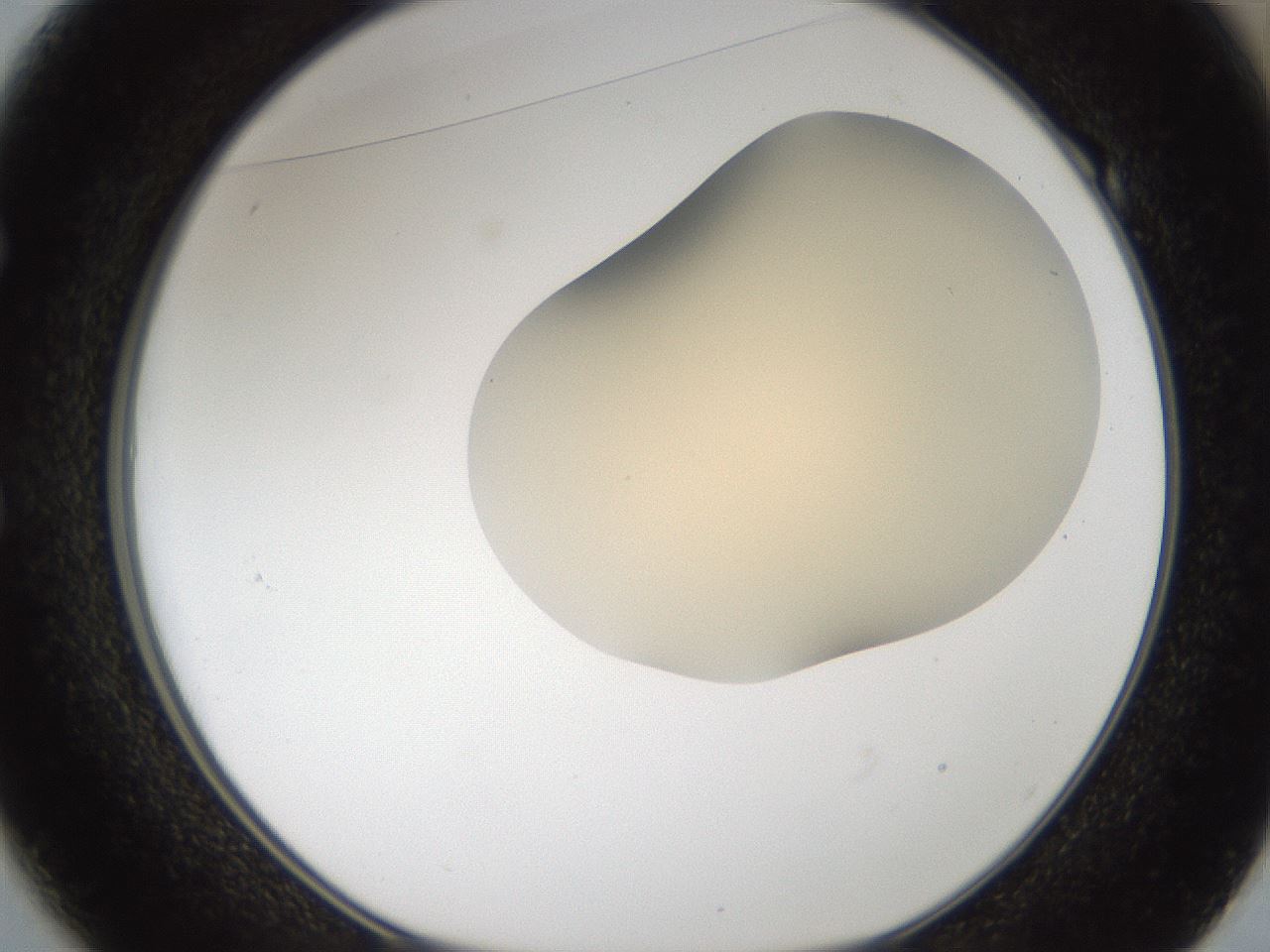 folderID52_plateID2052_batchID9022_wellNum49_profileID1_d1_r138519_ef.jpg