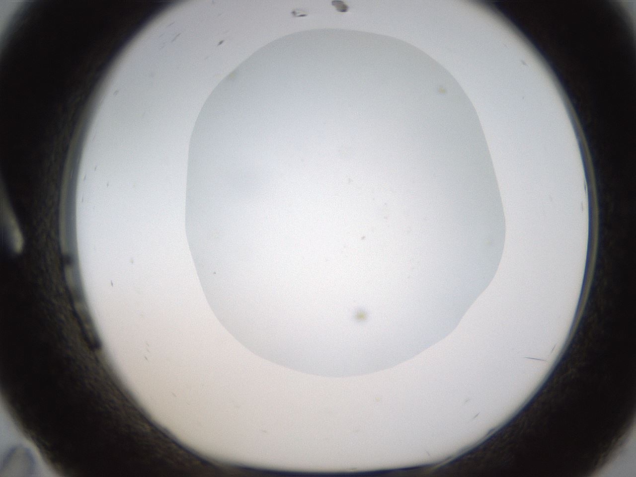 folderID434_plateID1434_batchID5443_wellNum11_profileID1_d1_r89325_ef.jpg