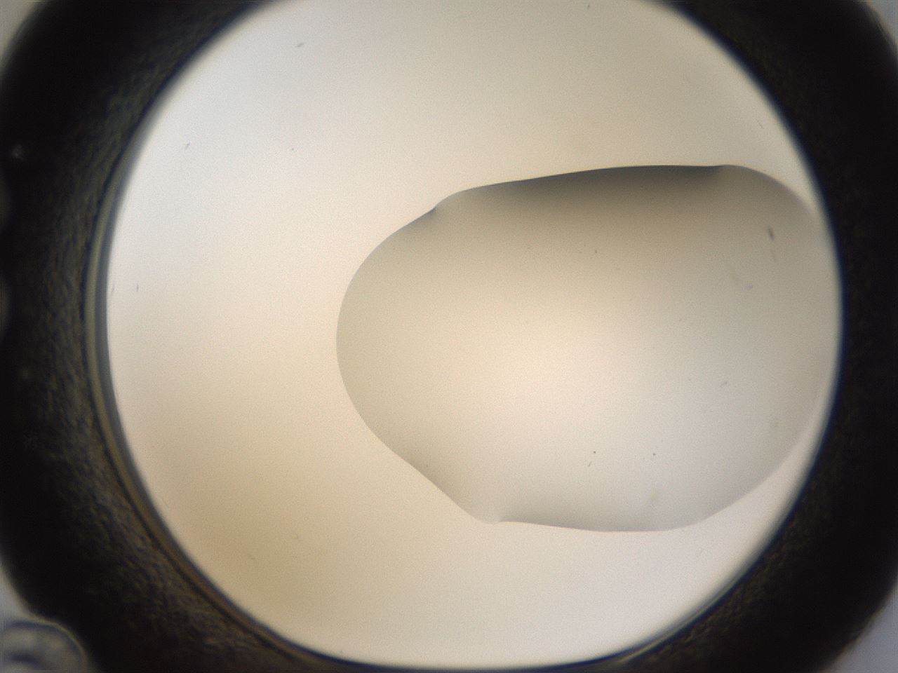 folderID57_plateID2057_batchID9024_wellNum36_profileID1_d1_r138746_ef.jpg