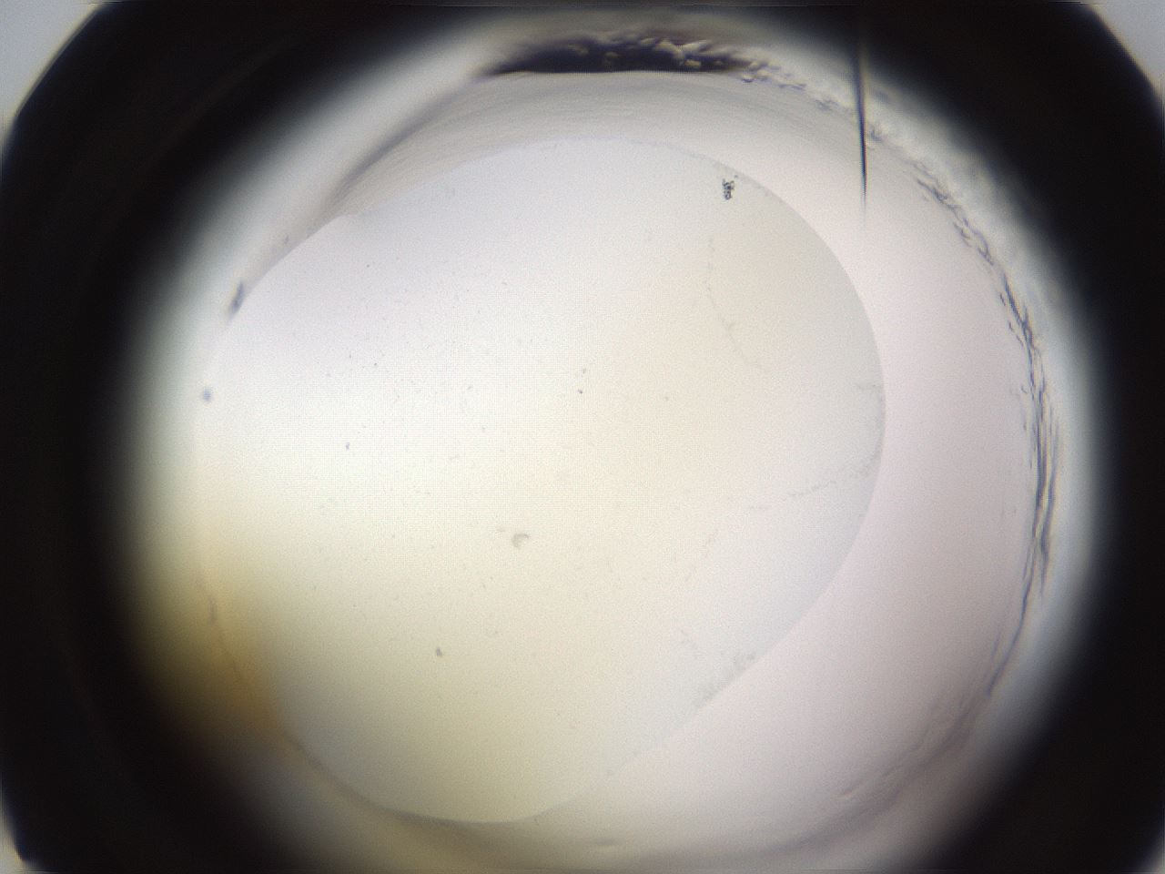 folderID590_plateID2590_batchID13170_wellNum22_profileID1_d1_r201096_ef.jpg