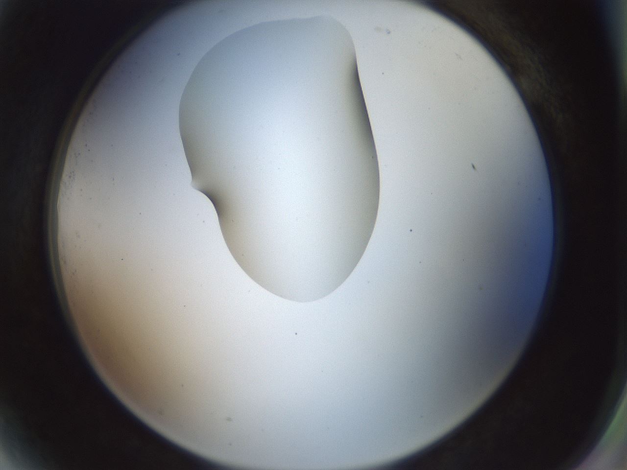 folderID443_plateID1443_batchID5498_wellNum81_profileID1_d2_r91101_ef.jpg