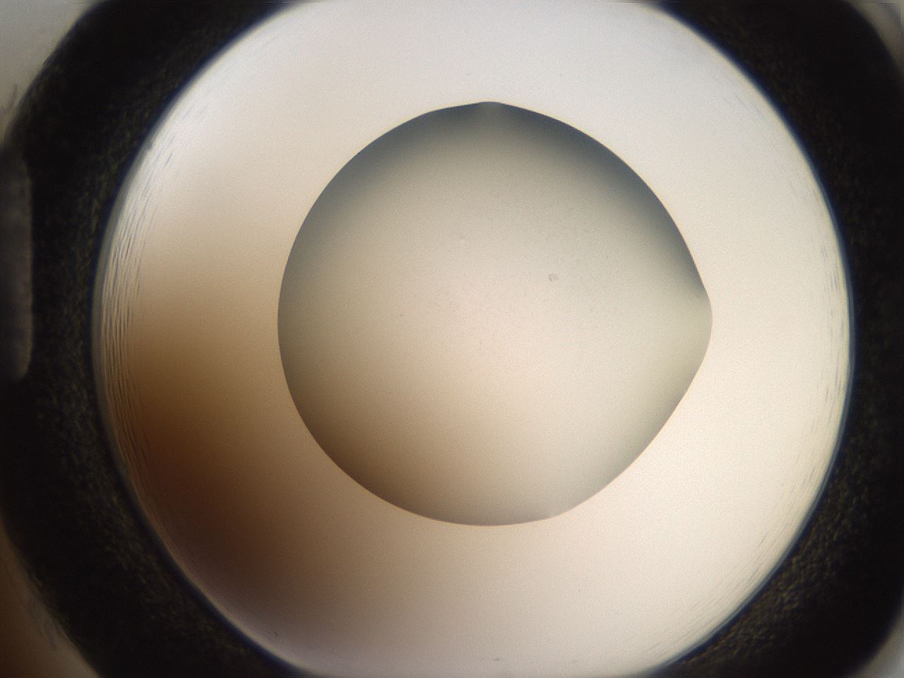 folderID185_plateID2185_batchID9951_wellNum85_profileID1_d1_r147915_ef.jpg