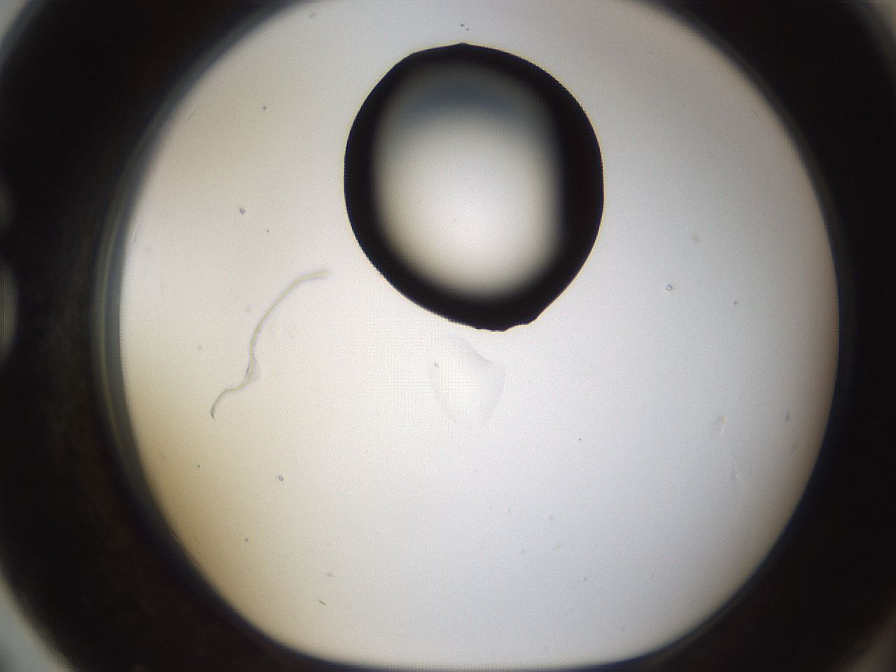 folderID187_plateID1187_batchID3361_wellNum79_profileID1_d1_r65389_ef.jpg