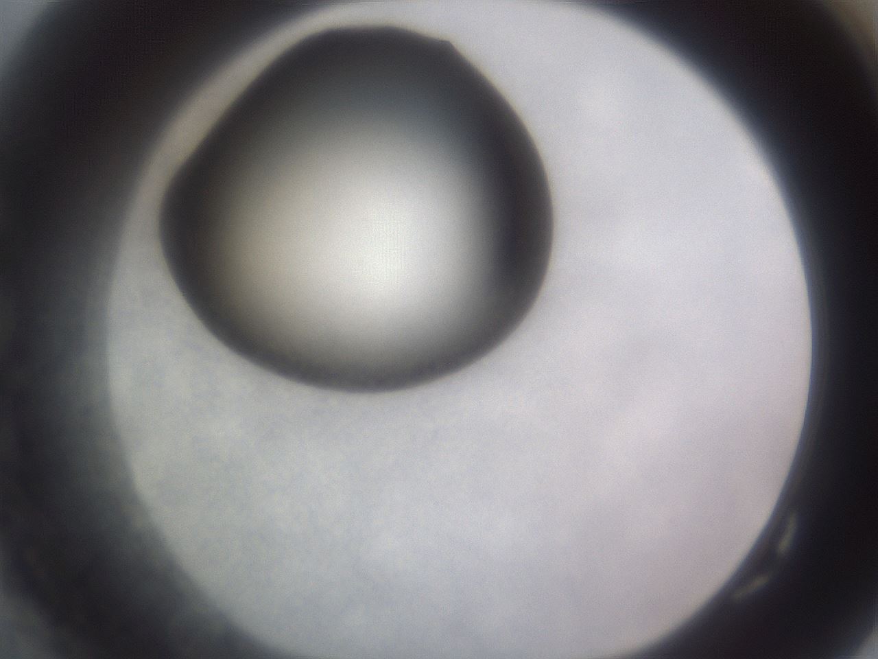 folderID191_plateID2191_batchID9956_wellNum82_profileID1_d1_r148392_ef.jpg