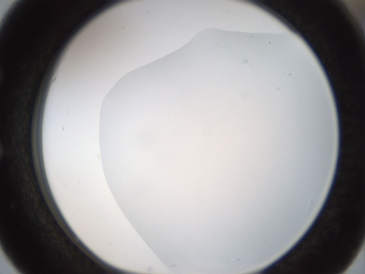 folderID194_plateID1194_batchID3367_wellNum51_profileID1_d1_r65745_ef.jpg
