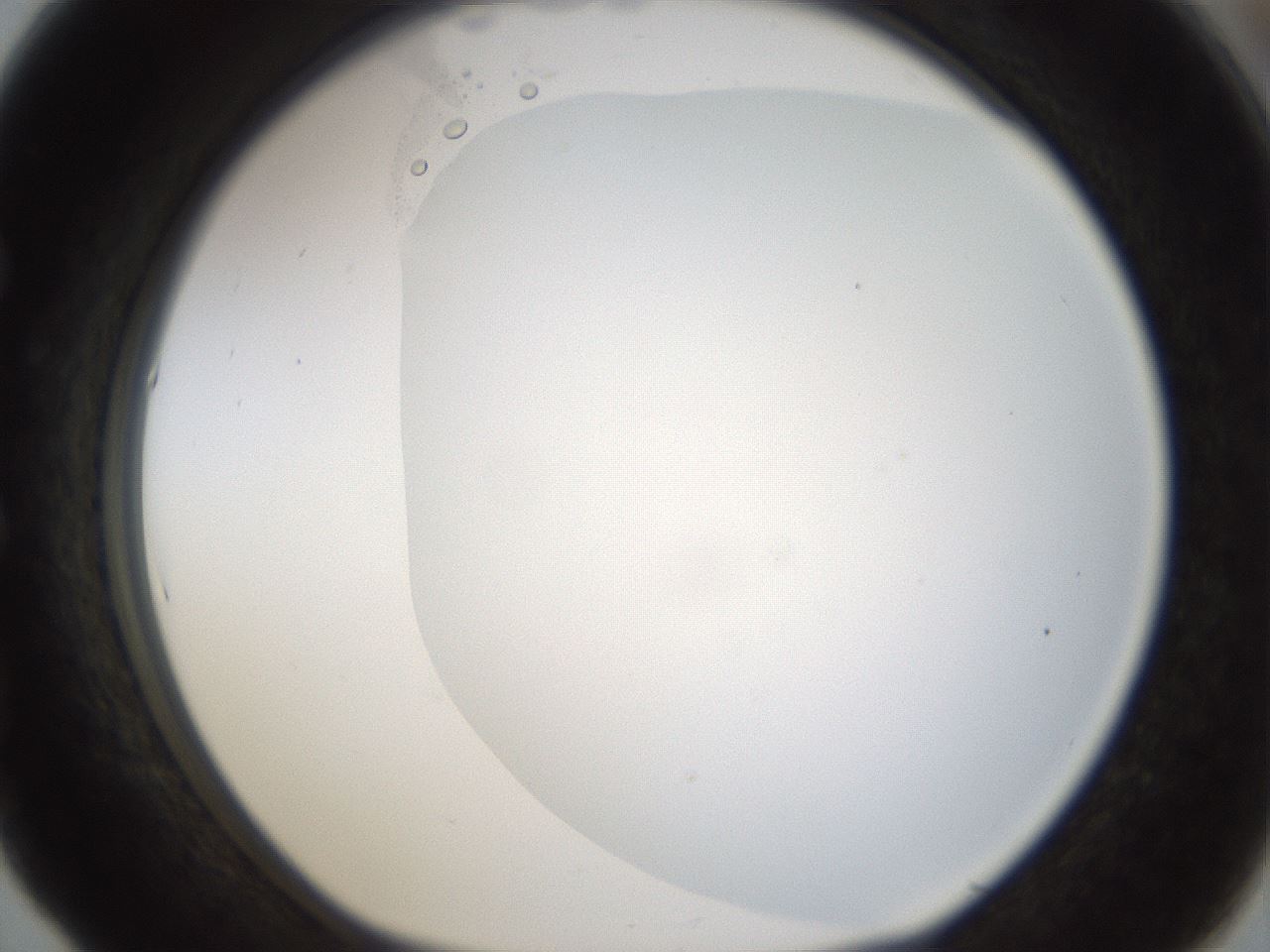 folderID194_plateID1194_batchID3367_wellNum53_profileID1_d1_r65747_ef.jpg