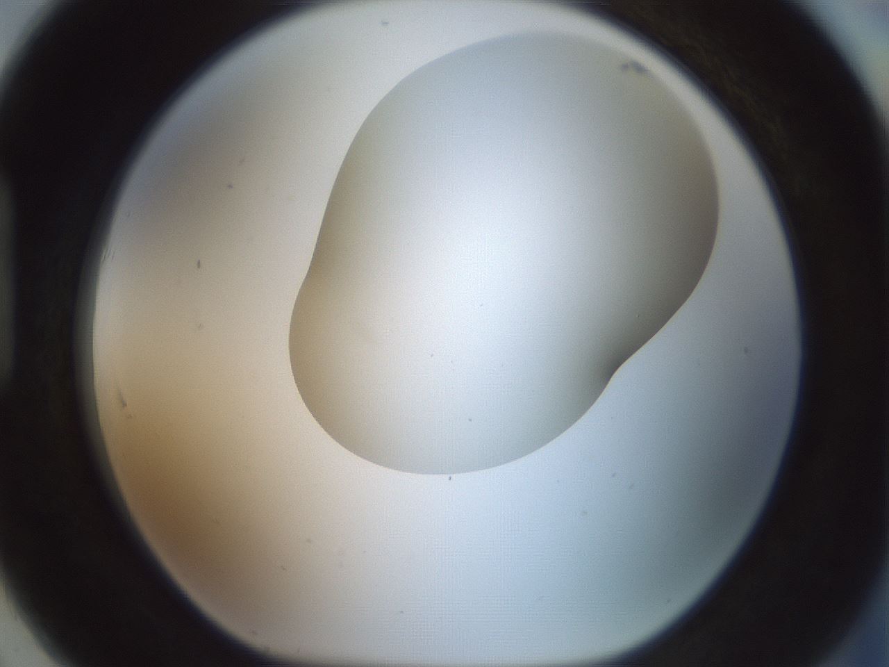 folderID200_plateID1200_batchID3525_wellNum91_profileID1_d1_r66457_ef.jpg