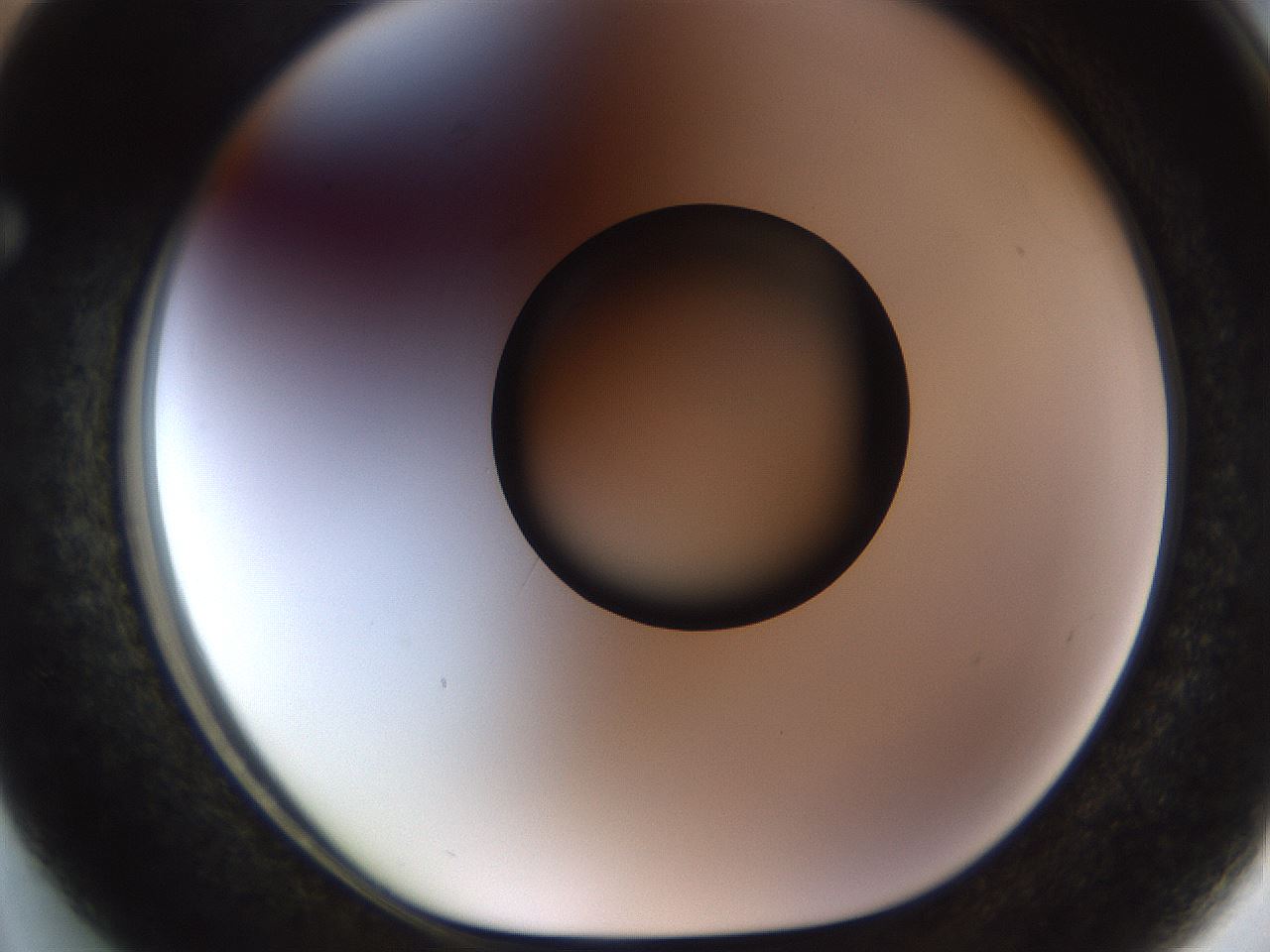 folderID449_plateID1449_batchID5529_wellNum63_profileID1_d1_r92058_ef.jpg