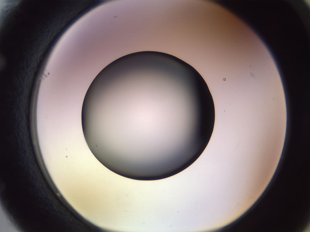 folderID451_plateID1451_batchID5526_wellNum61_profileID1_d1_r91864_ef.jpg