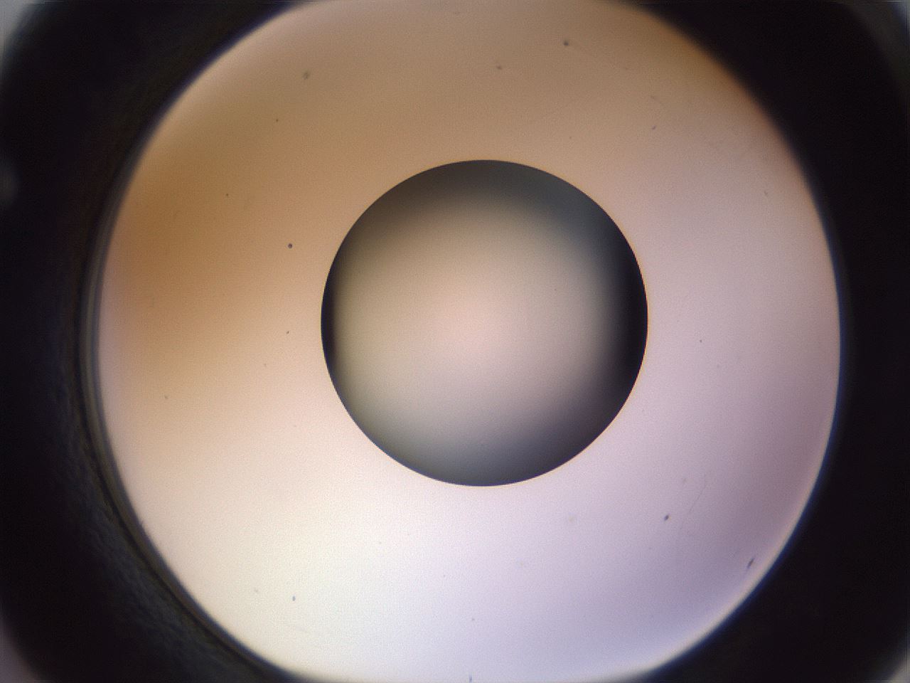 folderID451_plateID1451_batchID5526_wellNum62_profileID1_d1_r91865_ef.jpg
