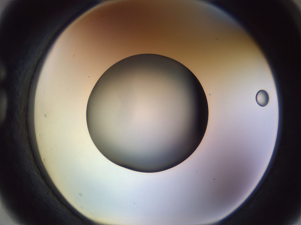 folderID451_plateID1451_batchID5526_wellNum75_profileID1_d1_r91878_ef.jpg
