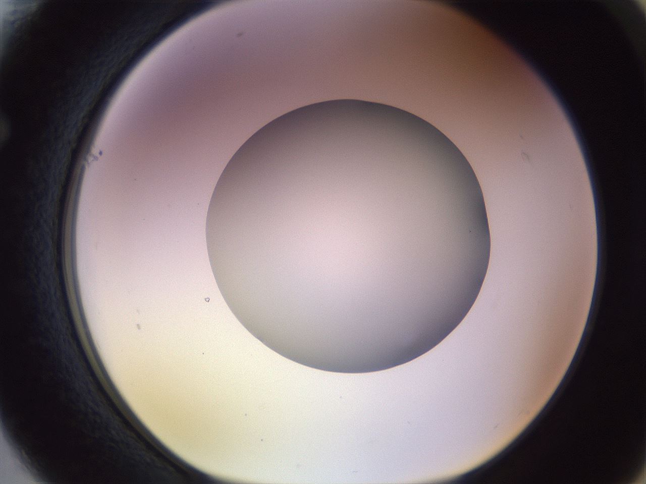 folderID452_plateID1452_batchID5530_wellNum61_profileID1_d1_r92248_ef.jpg