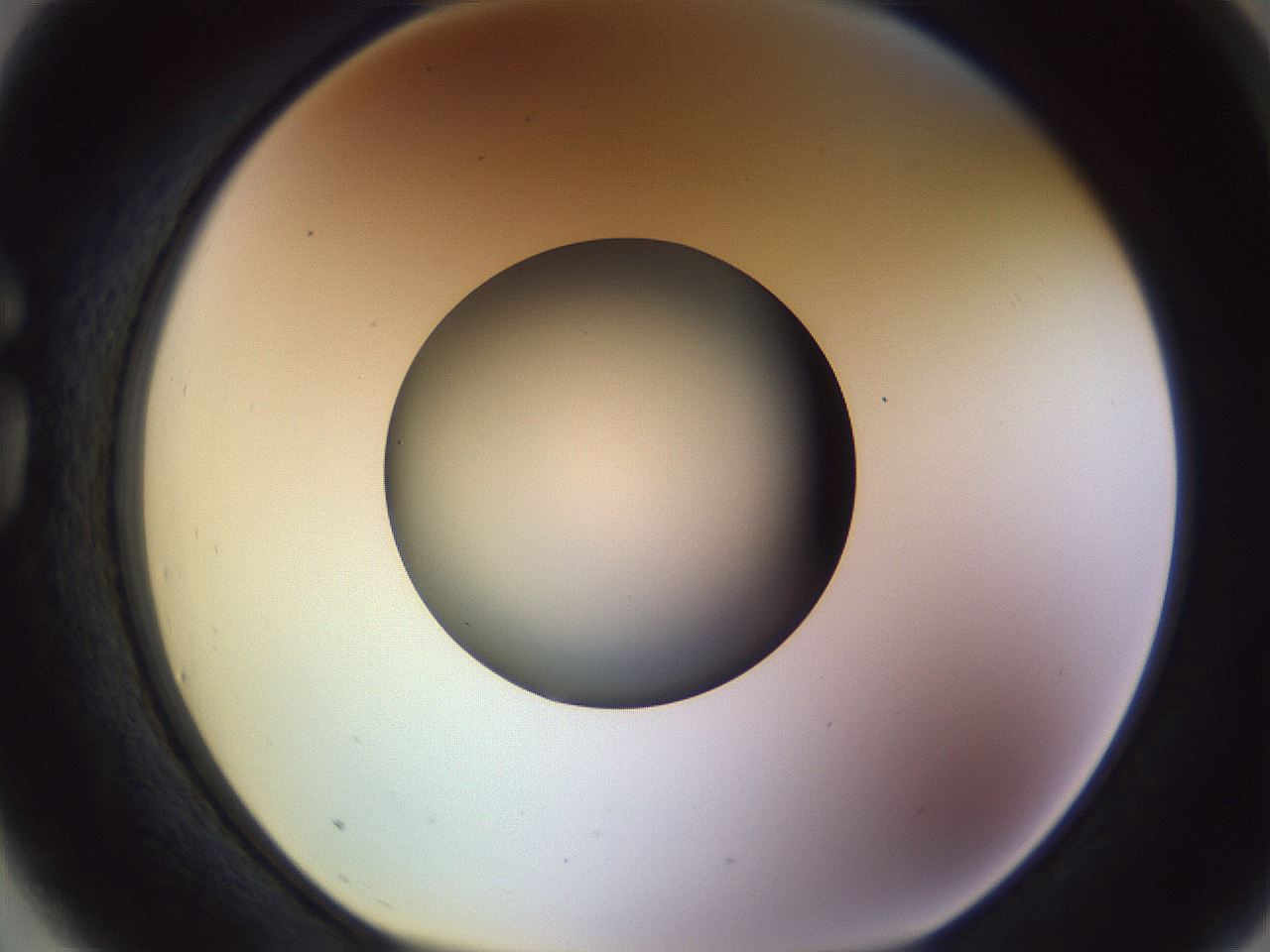 folderID452_plateID1452_batchID5530_wellNum75_profileID1_d1_r92262_ef.jpg