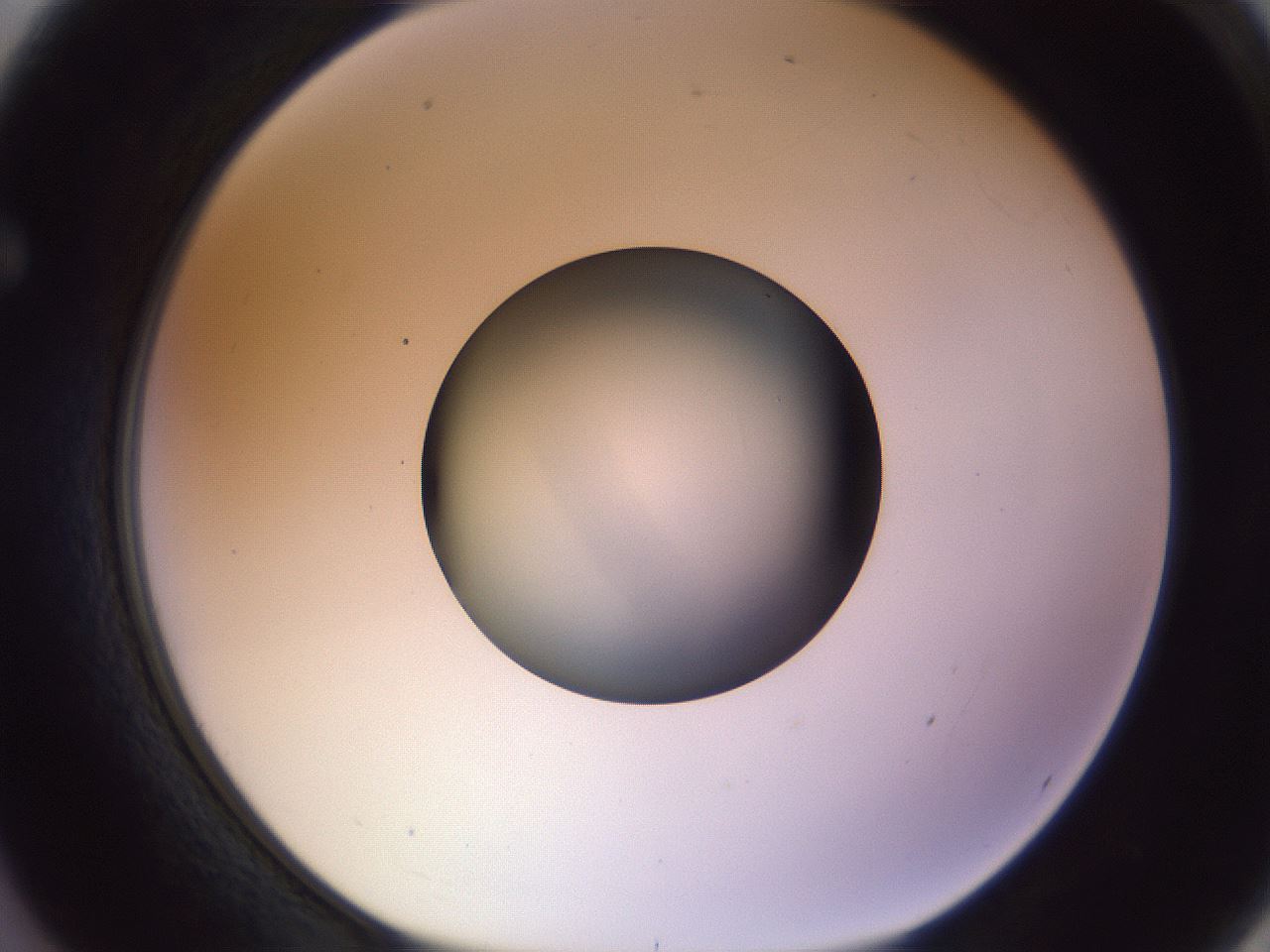 folderID452_plateID1452_batchID5530_wellNum62_profileID1_d1_r92249_ef.jpg