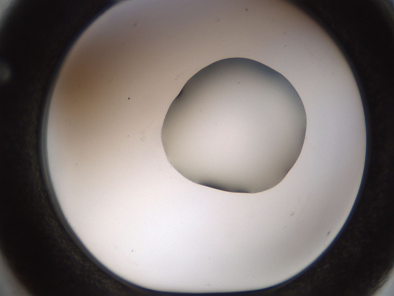 folderID454_plateID1454_batchID5531_wellNum62_profileID1_d1_r92345_ef.jpg