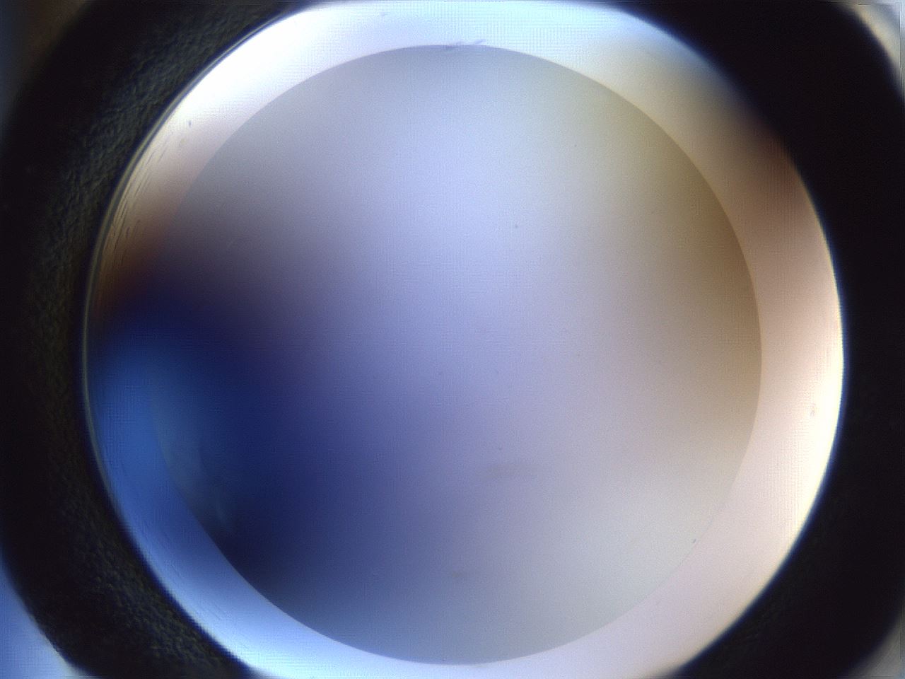 folderID205_plateID1205_batchID3629_wellNum85_profileID1_d2_r66921_ef.jpg