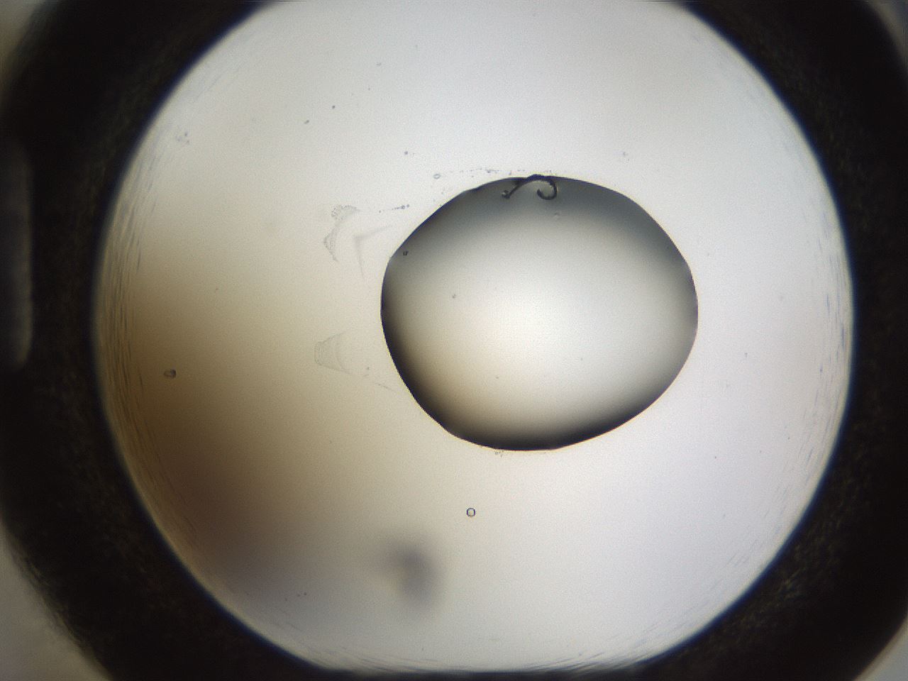folderID454_plateID1454_batchID5531_wellNum85_profileID1_d1_r92368_ef.jpg