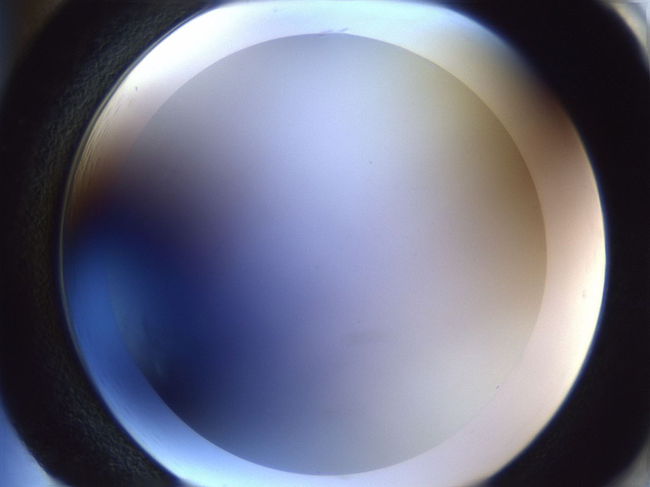 folderID205_plateID1205_batchID3675_wellNum85_profileID1_d2_r66921_ef.jpg