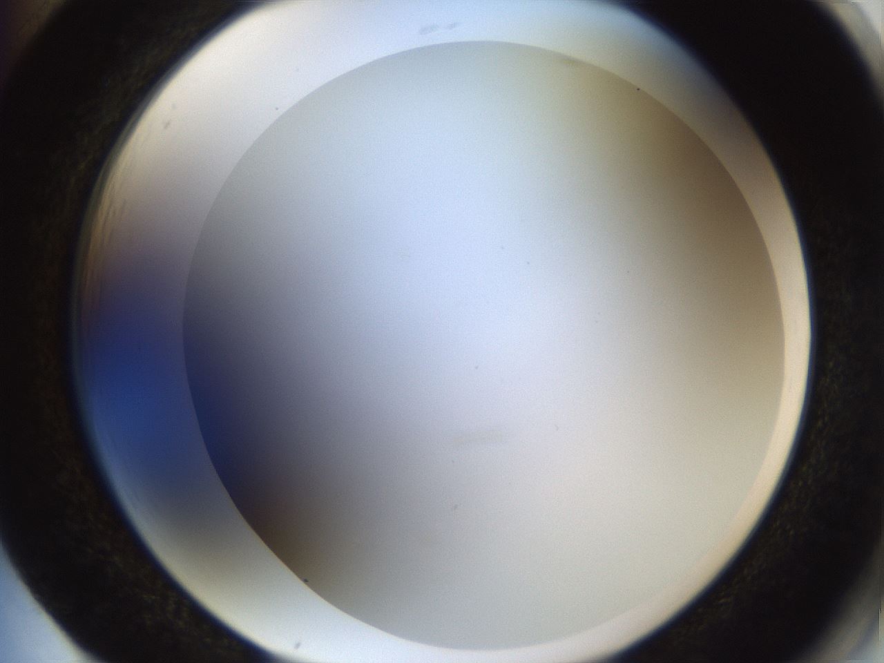 folderID206_plateID1206_batchID3677_wellNum85_profileID1_d2_r67113_ef.jpg
