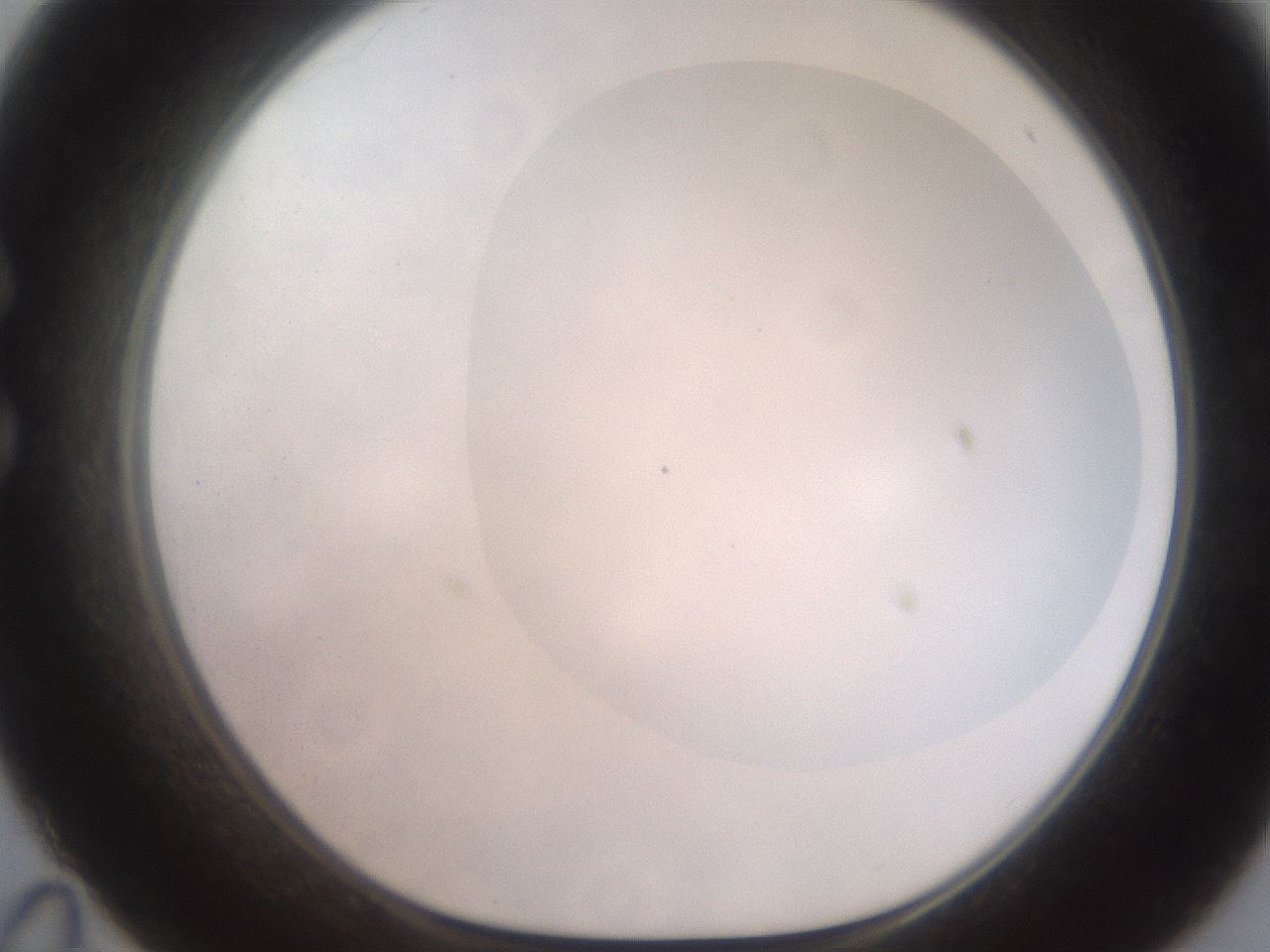 folderID464_plateID2464_batchID12065_wellNum35_profileID1_d1_r187230_ef.jpg