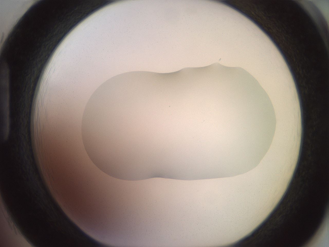 folderID467_plateID2467_batchID12051_wellNum85_profileID1_d1_r186512_ef.jpg