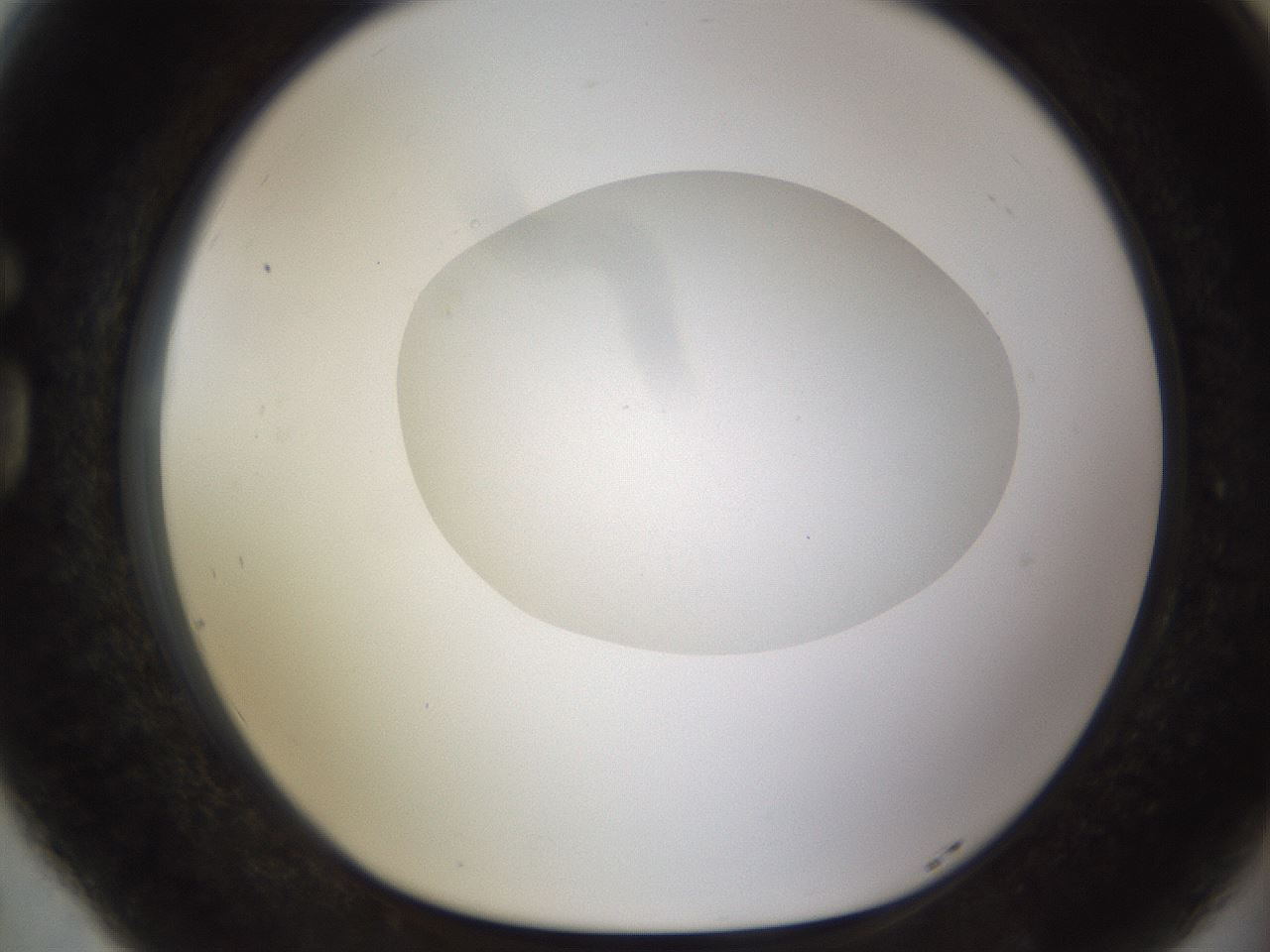 folderID492_plateID1492_batchID5857_wellNum77_profileID1_d1_r94596_ef.jpg