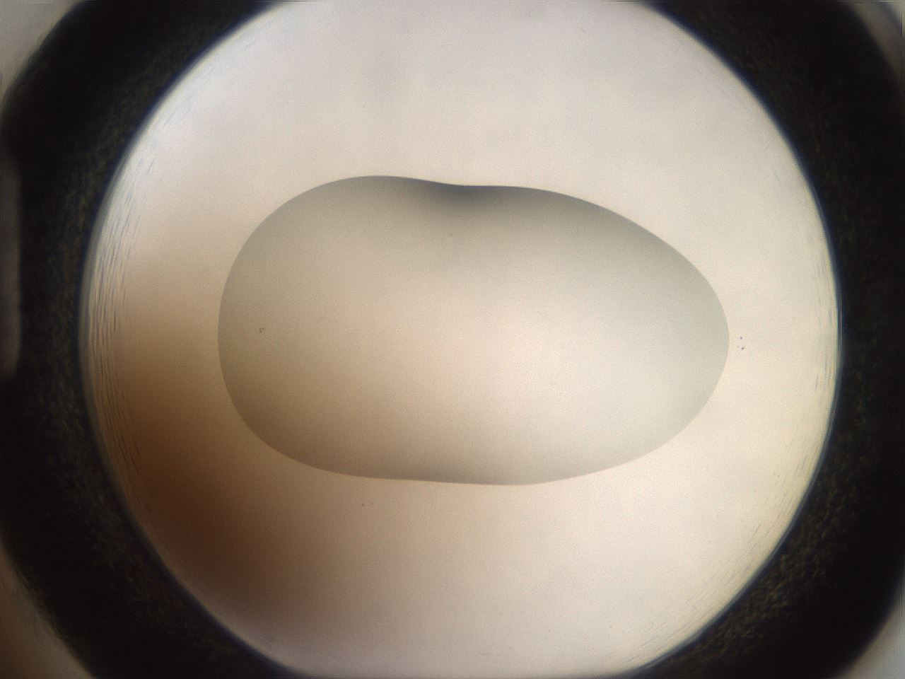 folderID501_plateID2501_batchID12082_wellNum85_profileID1_d1_r188144_ef.jpg