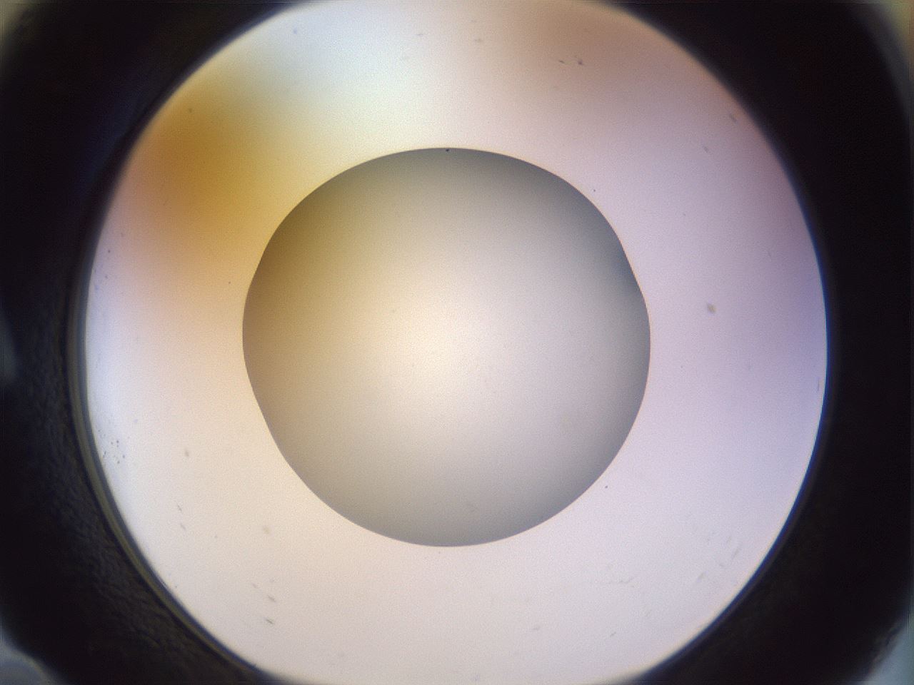 folderID504_plateID1504_batchID5871_wellNum10_profileID1_d1_r95546_ef.jpg